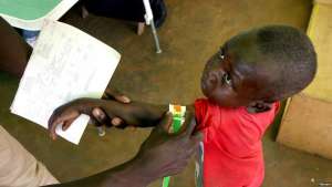 FILE - A Congolese boy has his arm measured for malnutrition in a clinic run by medical charity Medecins Sans Frontieres in the remote town of Dubie in Congo's southeastern Katanga province, March 18, 2006.