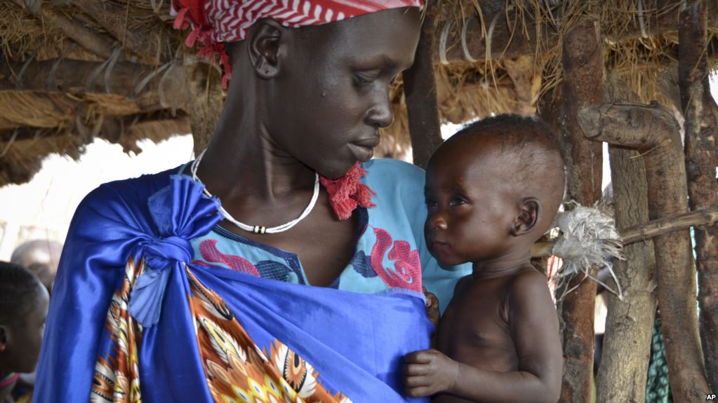 FILE - Elizabeth Nyakoda holds her severely malnourished 10-month old daughter at the feeding center for children in Jiech, Ayod County, South Sudan, Dec. 10, 2017.